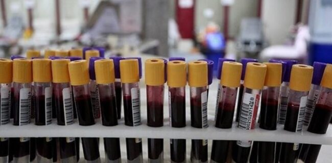 پویش “نذر خون” توسط بسیج جامعه پزشکی در استان لرستان اجرا می‌شود
